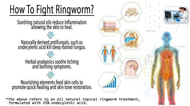 how to know <a href="https://digitales.com.au/blog/wp-content/review/anti-fuxgus/what-to-give-cattle-for-foot-rot.php">read more</a> scalp ringworm is healing